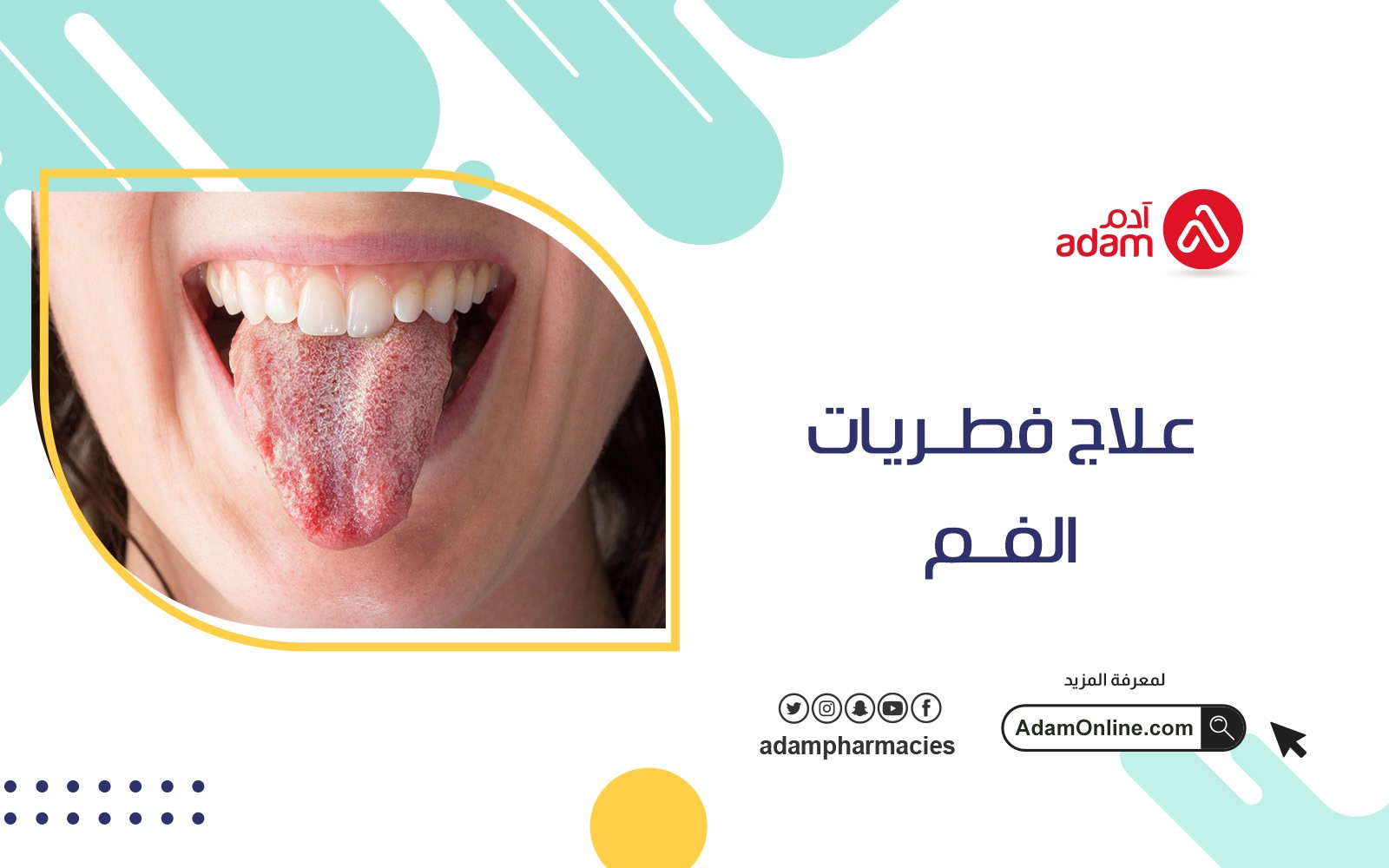 Oral fungus treatment